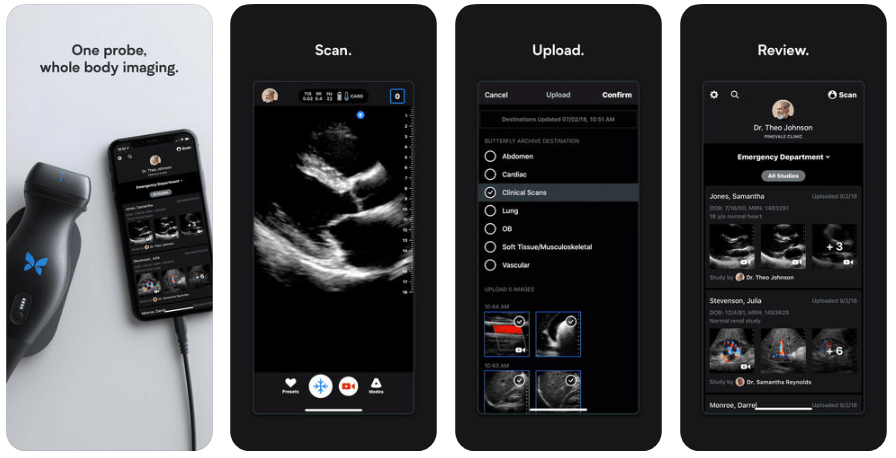 Butterfly IQ - Ultrasound Apple, Приложения